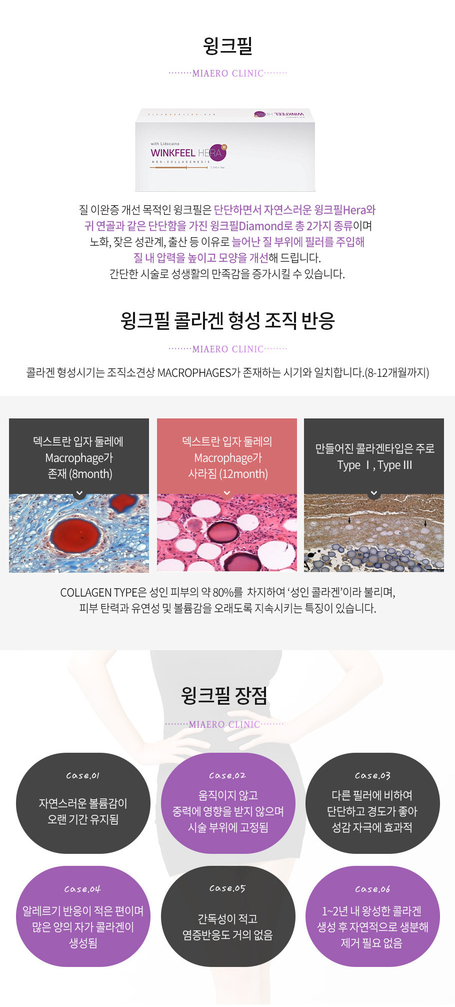 윙크필